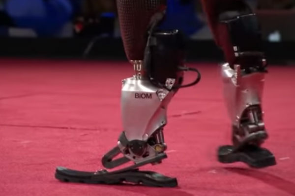 “Людину не зламати!” Історія створення протезів, що дозволяють бігати і танцювати. mit media lab, хью герр, біонічний протез, проект, технологія