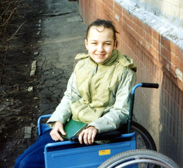 «Как только мне в мозг вживили «батарейку», я встала с инвалидного кресла, в котором провела 20 лет». наталья титова, заболевание, инвалидное кресло, нейростимулятор, торсионная дистония