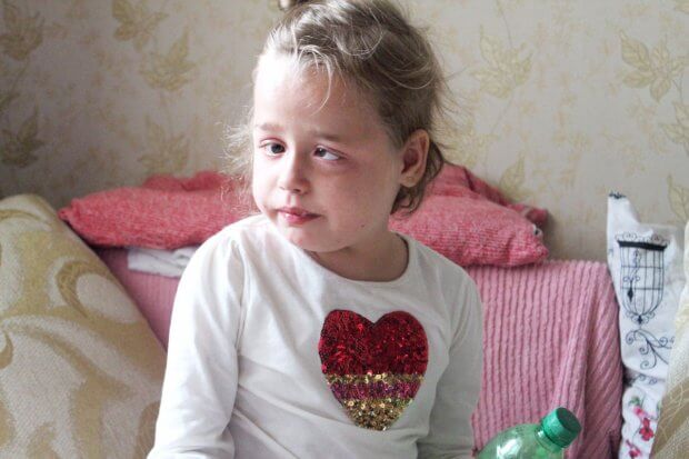 Синдром особливості: як у Львові живеться дітям із вадами розвитку. львів, вади розвитку, діагноз, хвороба, інвалідність
