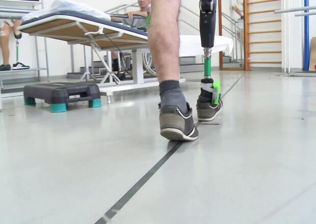 Новый нейропротез ноги воспринимается центральной нервной системой пользователя в качестве продолжения конечности. rheo xc, нейропротез, пациент, сенсорная стелька, ходьба