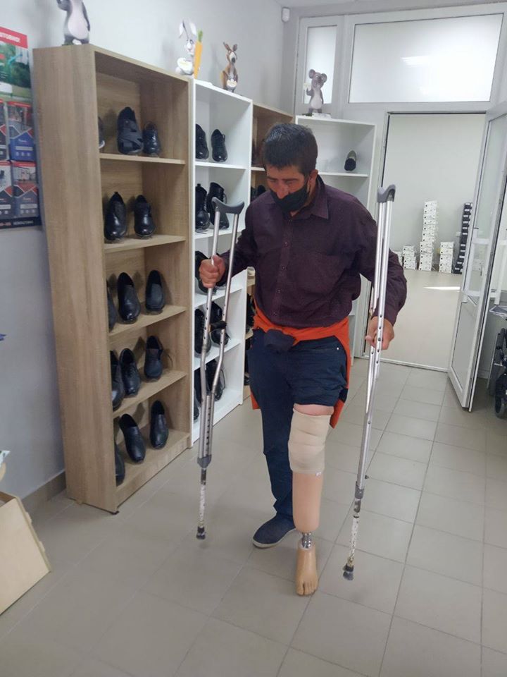 Безхатько з Вінниці отримав протез для втраченої кінцівки (ВІДЕО). безхатько, кінцівка, протез, протезування, інвалідність