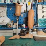 У Полтаві для цивільних та військових виготовляють протези (ФОТО, ВІДЕО)