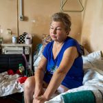 Жінка, яку поранило на Луганщині, отримає протез завдяки львівському благодійному проєкту
