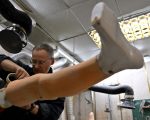 Війна та роботизація: над якими розробками протезів працюють науковці. війна, дослідження, кінцівка, пацієнт, протез