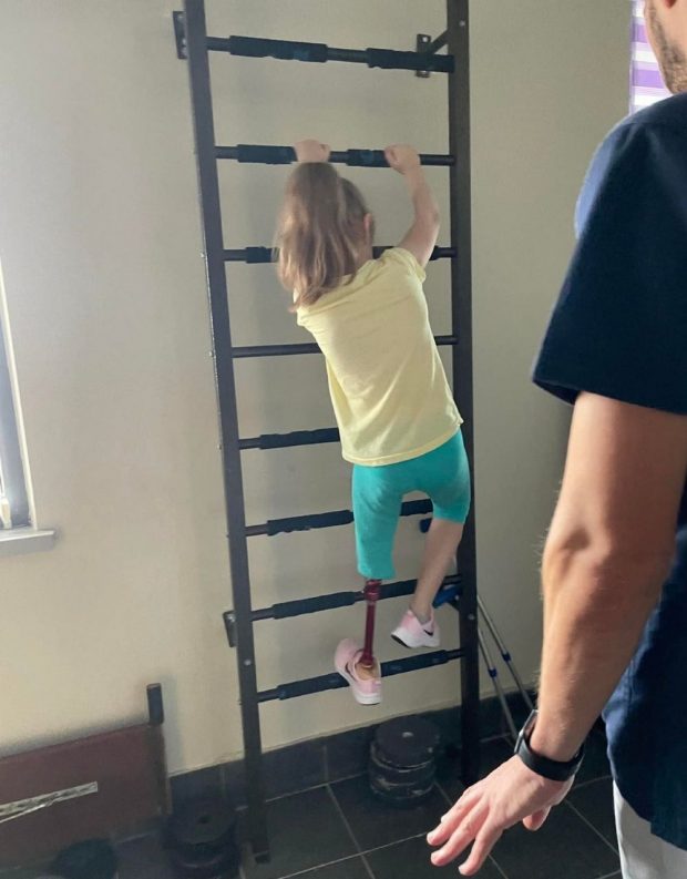 У київському Охматдиті 6-річна Марина робить перші кроки на протезі. ндсл охматдит, дівчинка, протез, протезування, реабілітація