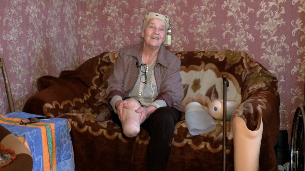 Танцює та бігає на протезі у 74 роки: жінка з Анисова, яка постраждала при бомбардуванні, пройшла реабілітацію в Австрії. австрія, любов миронівна, поранення, протез, реабілітація