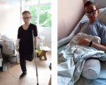 Поранення, перелом та ампутація – як 28-річний мешканець Донеччини відновлює право на інвалідність. максим забігайло, угспл, обстріл, поранення, інвалідність