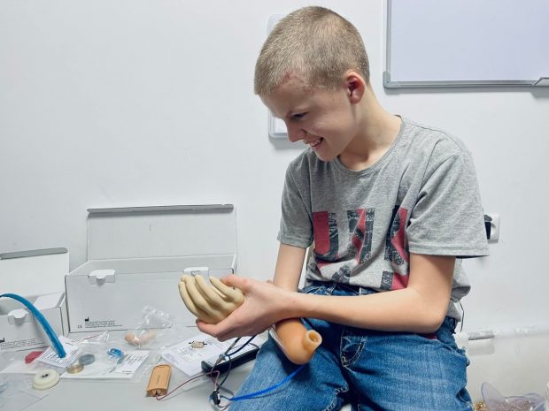 У Львові почали встановлювати дитячі протези. львів, національний реабілітаційний центр незламні, протез, протезування, рука