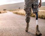Військовим спростять отримання виплати на протезування: що відомо. виплата, військовий, лікарський висновок, протез, протезування