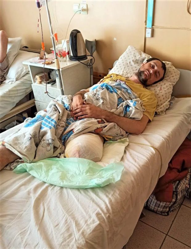 “Мені ще пощастило”: історія електромонтера з Луганщини, який повертав електрику під обстрілами та втратив ногу. євген перепелиця, електромонтер, обстріл, протез, реабілітація