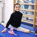 Маленька Саша Паскаль отримала найсучасніший біонічний протез (ФОТО, ВІДЕО)