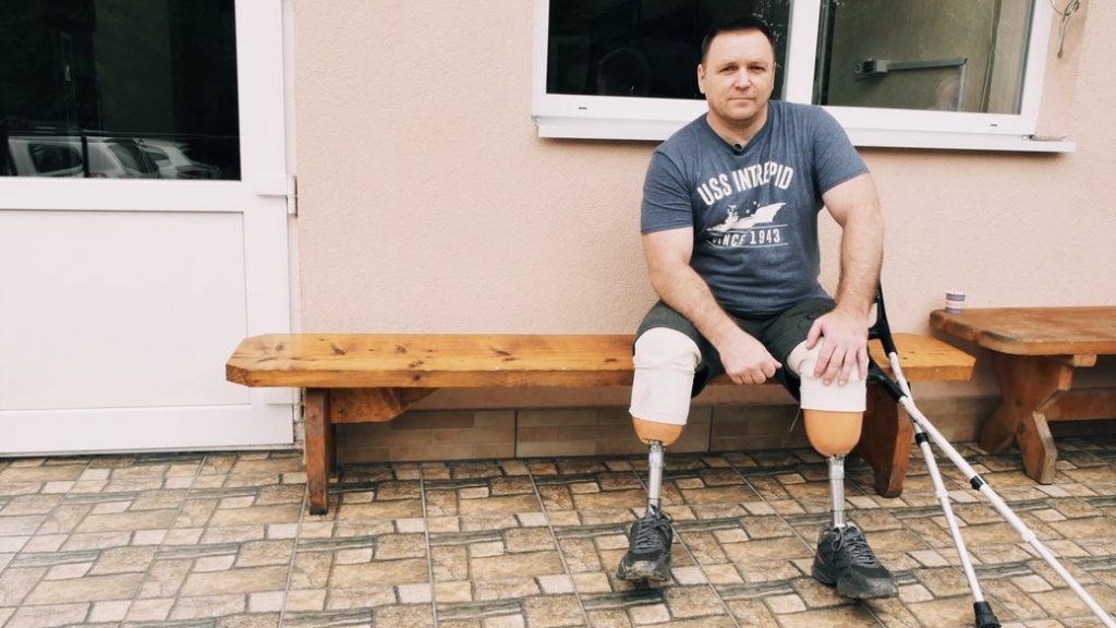 “Тепер я — залізна людина”. Історія херсонця, який після 9 років війни втратив ноги й освоює протези на Буковині (ФОТО, ВІДЕО). вашківецька лікарня, віктор ковбаса, військовий, поранення, протез