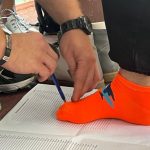 Жителі Миколаївщини можуть подати заяву на отримання безкоштовних протезів (ФОТО, ВІДЕО)