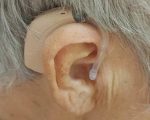 На Херсонщині 40 мешканців деокупованих територій отримали слухові протези (ФОТО). херсонщина, мешканець, послуга, слуховий протез, слухопротезування