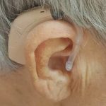 На Херсонщині 40 мешканців деокупованих територій отримали слухові протези (ФОТО)