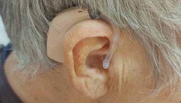 На Херсонщині 40 мешканців деокупованих територій отримали слухові протези (ФОТО). херсонщина, мешканець, послуга, слуховий протез, слухопротезування