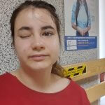 Пережила інсульт у 12 років: на Одещині переселенка з Мелітополя взяла під опіку підлітка з інвалідністю (ФОТО, ВІДЕО)