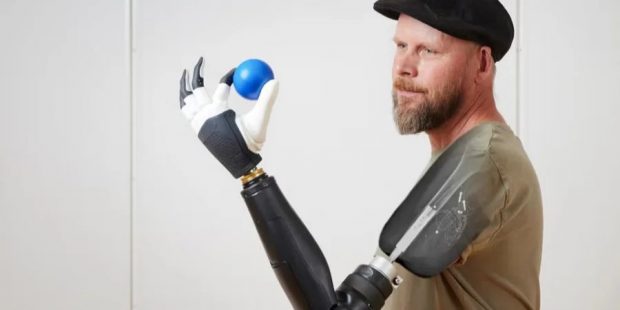 Унікальна технологія. У Швеції створили протез, який дозволяє рухати усіма пальцями окремо за допомогою нервів. швеція, біонічна рука, палец, протез, сила думки