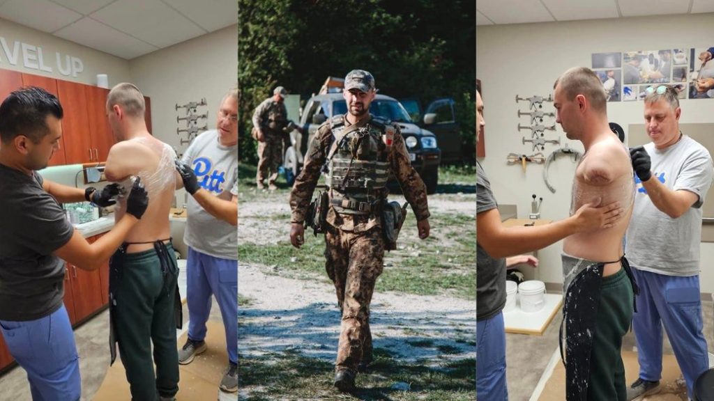Боєць, який втратив на війні обидві руки, готується до протезування у США. сша, юрій трохименко, боєць, поранення, протезування