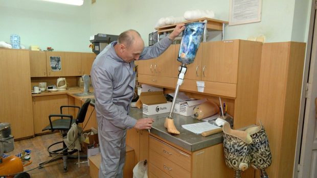 Усі витрати покриває держава: понад 600 людей пройшли протезування у Вінниці. вінниця, пацієнт, протез, протезно-ортопедичне підприємство, протезування