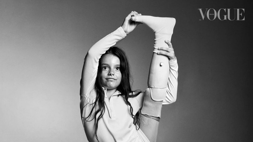 Видимі. Vogue представив соціальний проєкт, у якому показав людей з ампутаціями та протезами. vogue, протез, протезування, соціальний проєкт видимі, історії