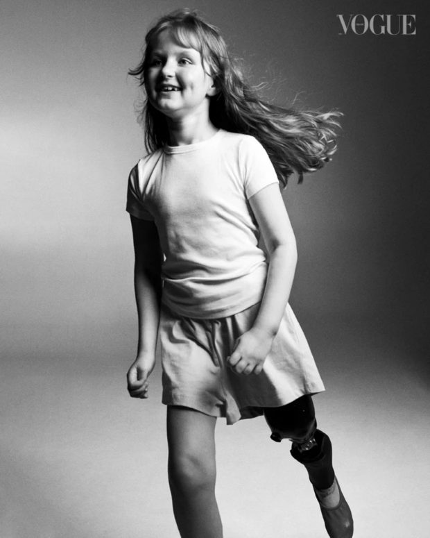 Видимі. Vogue представив соціальний проєкт, у якому показав людей з ампутаціями та протезами. vogue, протез, протезування, соціальний проєкт видимі, історії