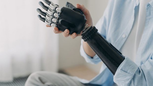 Людина чи робот: історія створення роботизованих медичних протезів. війна, ортезування, поранення, протез, протезування