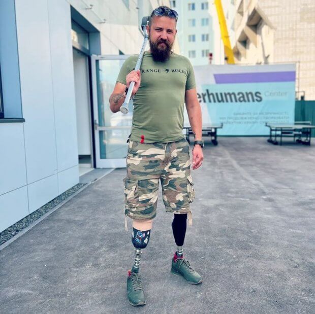 Втратив обидві ноги: історія ветерана ЗСУ, який після травми повернувся до роботи ветеринаром. олексій притула, ветеран зсу, ветеринар, поранення, протез
