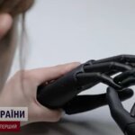 В Україні виробляють унікальні роботизовані руки для поранених військових