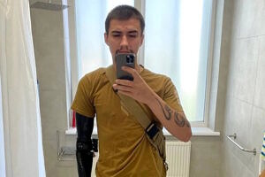 Травмувався, коли витягував поранених побратимів: у Львові встановили біонічну руку пораненому бійцю