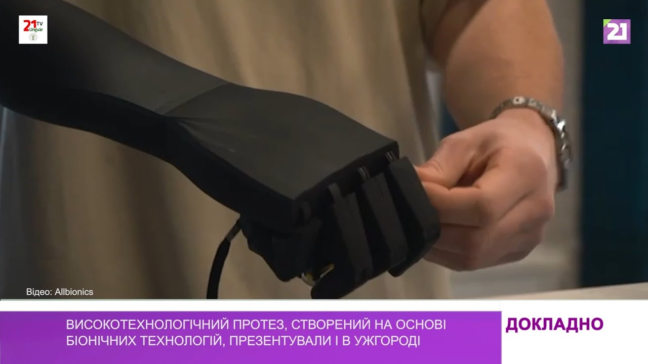 Високотехнологічний протез, створений на основі біонічних технологій, презентували і в Ужгороді (ВІДЕО). зустріч, презентація, протез, спортивно-реабілітаційний центр, ужгород