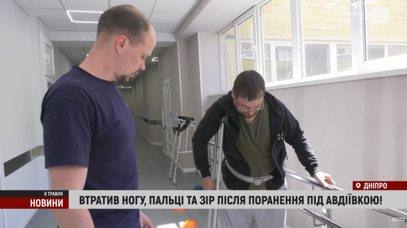 Бронік — весь в уламках, як їжак! Після скиду дрона залишився без ноги, пальців і з пробитим оком (ВІДЕО). поранення, протез, роман, сапер, травма