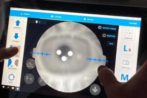 Світлина. 30 секунд, щоби зберегти зір: на Одещині та Чернігівщині пацієнтам із діабетом проводять цифровий скринінг зору з використанням штучного інтелекту. Новини, зір, Одещина, Чернігівщина, діабет, цифровий скринінг