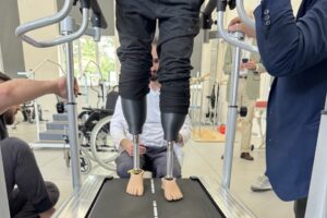 Світлина. На Закарпатті за допомогою 3D-друку вперше встановили протези пацієнту з подвійною ампутацією. Реабілітація, протез, протезування, військовий, Закарпаття, 3D-друк