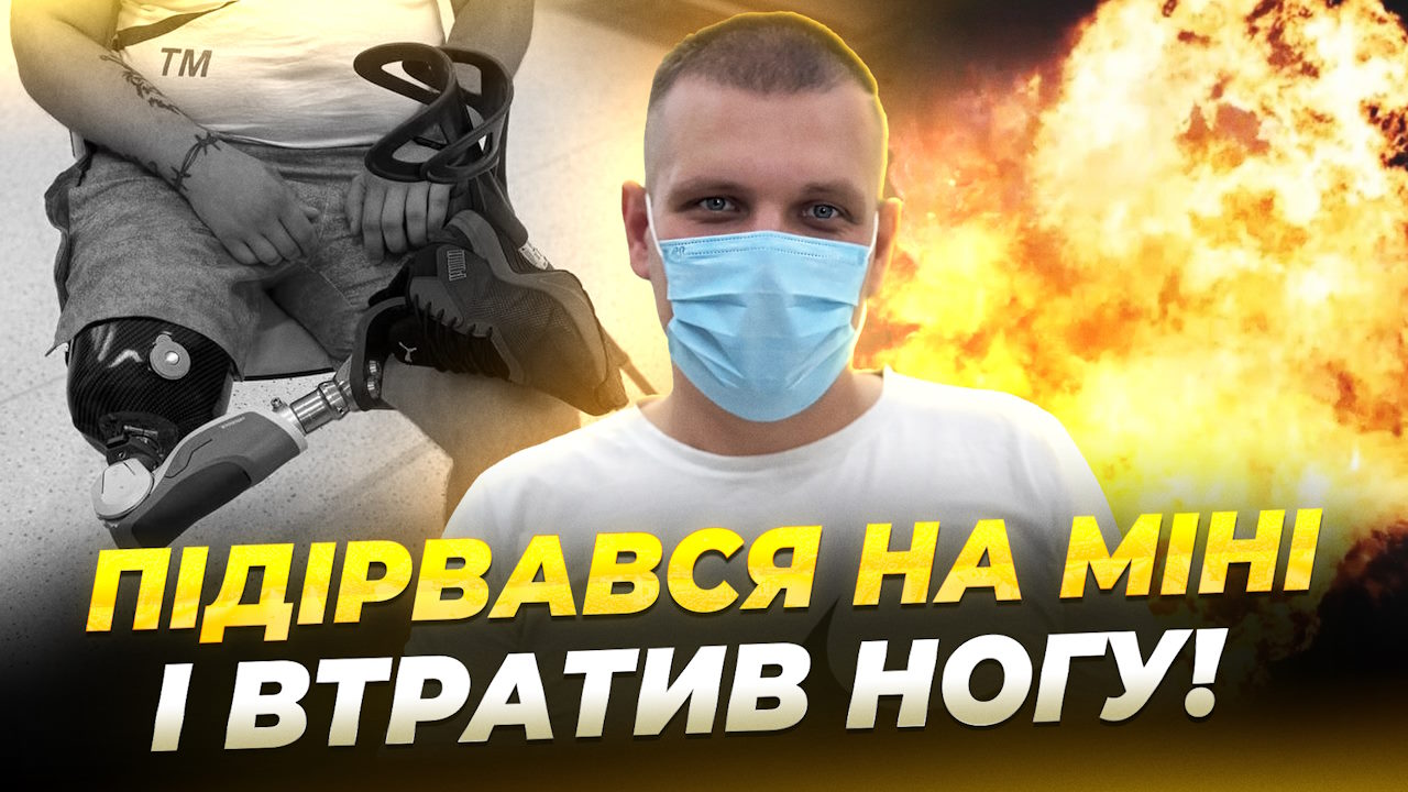 Військовий реабілітується у Дніпрі після ампутації кінцівки (ВІДЕО). військовий, дніпро, міна, поранення, протез
