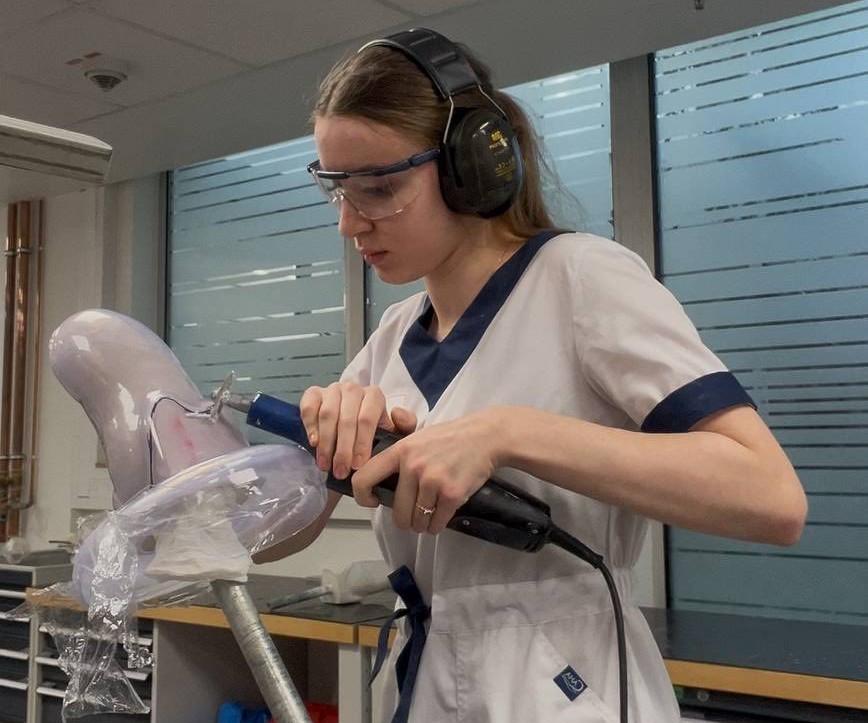 Студентка ХДУ вивчає новітні підходи до протезування кінцівок у Німеччині. анна, німеччина, протезування, студентка, хду