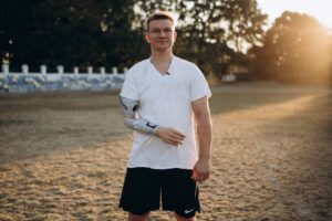 Життя після ампутації. Як українські ветерани відновлюються після втрати кінцівки: історія Олексія Дернова