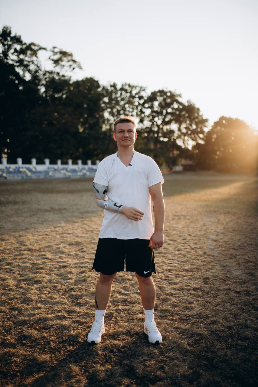 Життя після ампутації. Як українські ветерани відновлюються після втрати кінцівки: історія Олексія Дернова. mcop, військовий, олексій дернов, поранення, протез