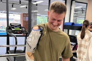 Світлина. Життя після ампутації. Як українські ветерани відновлюються після втрати кінцівки: історія Олексія Дернова. Реабілітація, протез, поранення, військовий, MCOP, Олексій Дернов