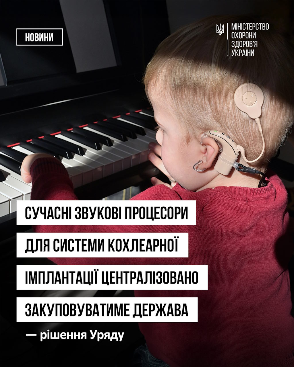 Сучасні звукові процесори для системи кохлеарної імплантації централізовано закуповуватиме держава — рішення Уряду. інвалідність, звуковий процесор, моз, порушення слуху, система кохлеарної імплантації