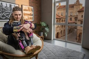 Сильні. Українки, які через війну втратили частину свого тіла, але не мужність і жагу до життя — фотопроєкт NV