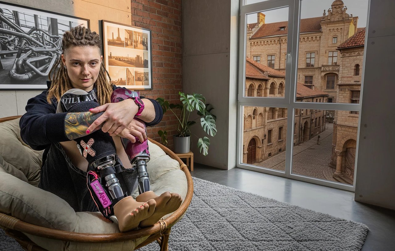 Сильні. Українки, які через війну втратили частину свого тіла, але не мужність і жагу до життя — фотопроєкт NV. ампутація, війна, поранення, протез, протезування