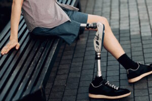 Як часто потрібно змінювати протези – поради українських спеціалістів