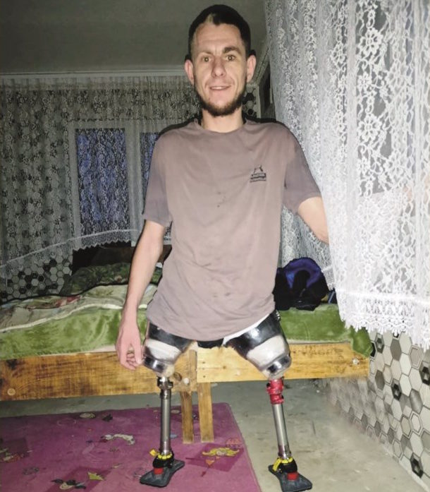 Воїн із Маневицької громади Андрій Ярошик – життя після втрати ніг і клінічної смерті. ампутація, андрій ярошик, захисник, поранення, протез