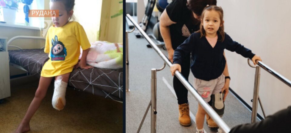 Поранена росіянами 5-річна Марійка з Дніпропетровщини вчиться ходити на протезі (ФОТО). protez foundation, марійка, поранення, протез, фахівець